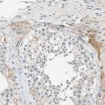 COL12A1 Antibody in Immunohistochemistry (IHC)