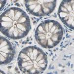 LHPP Antibody in Immunohistochemistry (IHC)