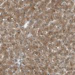 LHPP Antibody in Immunohistochemistry (IHC)