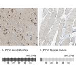 LHPP Antibody