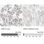 CD93 Antibody in Immunohistochemistry (IHC)