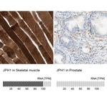 JPH1 Antibody in Immunohistochemistry (IHC)