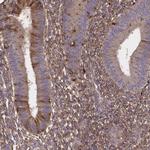 SFRP4 Antibody in Immunohistochemistry (IHC)