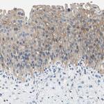 PNKD Antibody in Immunohistochemistry (IHC)