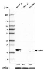 PNKD Antibody in Western Blot (WB)