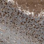 RHOT1 Antibody in Immunohistochemistry (IHC)