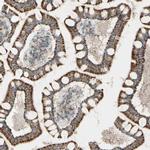 RHOT1 Antibody in Immunohistochemistry (IHC)