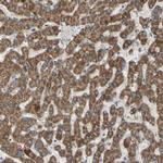 RHOT1 Antibody in Immunohistochemistry (IHC)