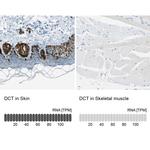 DCT Antibody in Immunohistochemistry (IHC)