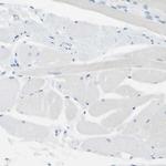 DCT Antibody in Immunohistochemistry (IHC)