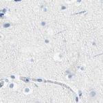 DCT Antibody in Immunohistochemistry (IHC)