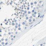 DCT Antibody in Immunohistochemistry (IHC)