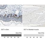 DCT Antibody in Immunohistochemistry (IHC)