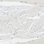 DCT Antibody in Immunohistochemistry (IHC)