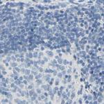 DCT Antibody in Immunohistochemistry (IHC)