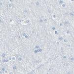 DCT Antibody in Immunohistochemistry (IHC)