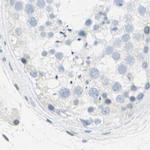 DCT Antibody in Immunohistochemistry (IHC)