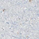 B4GALT1 Antibody in Immunohistochemistry (IHC)