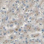 B4GALT1 Antibody in Immunohistochemistry (IHC)