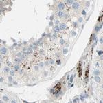 B4GALT1 Antibody in Immunohistochemistry (IHC)