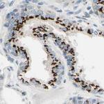 B4GALT1 Antibody in Immunohistochemistry (IHC)