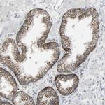 FXYD3 Antibody in Immunohistochemistry (IHC)