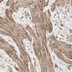 DPYSL3 Antibody in Immunohistochemistry (IHC)