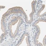 C2orf33 Antibody in Immunohistochemistry (IHC)