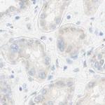 MANEA Antibody in Immunohistochemistry (IHC)