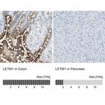 LETM1 Antibody in Immunohistochemistry (IHC)