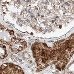 ZNF690 Antibody in Immunohistochemistry (IHC)