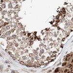 ZNF690 Antibody in Immunohistochemistry (IHC)