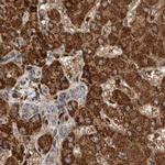 ZNF690 Antibody in Immunohistochemistry (IHC)