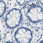 PASD1 Antibody in Immunohistochemistry (IHC)