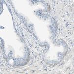 GALNTL5 Antibody in Immunohistochemistry (IHC)