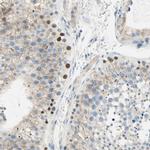 PASD1 Antibody in Immunohistochemistry (IHC)