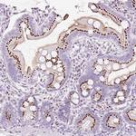 SDF4 Antibody in Immunohistochemistry (IHC)