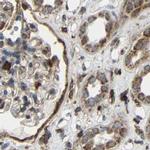 C1GALT1 Antibody in Immunohistochemistry (IHC)