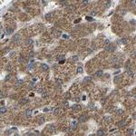 C1GALT1 Antibody in Immunohistochemistry (IHC)