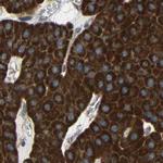 C1GALT1 Antibody in Immunohistochemistry (IHC)