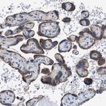 ZP2 Antibody in Immunohistochemistry (IHC)