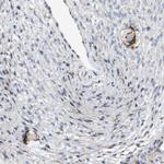 ZP2 Antibody in Immunohistochemistry (IHC)