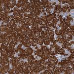 RPL10 Antibody in Immunohistochemistry (IHC)