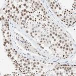 SAP18 Antibody in Immunohistochemistry (IHC)