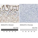 B4GALNT3 Antibody