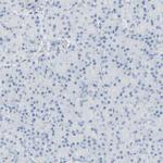 B4GALNT3 Antibody in Immunohistochemistry (IHC)