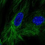 KCNE4 Antibody in Immunocytochemistry (ICC/IF)