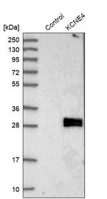 KCNE4 Antibody in Western Blot (WB)