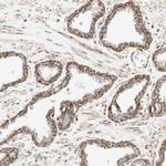 TOMM20 Antibody in Immunohistochemistry (IHC)