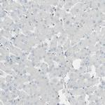 GALNT6 Antibody in Immunohistochemistry (IHC)